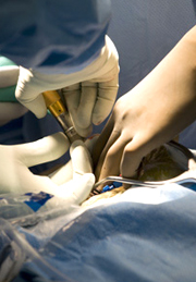 surgeons hands